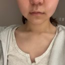 신대한엘피지제1 | [한남동 피부관리] 엘피지오한남 - 브이라인 관리 추천