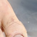 영통구 내성발톱 관리 성지, 레푸스 망포점 솔직 방문기: 걷는 즐거움을 되찾다