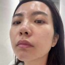 스파비알 네이버블로그