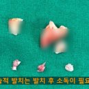 뽑고가요 이미지
