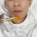 제이비비 동탄점 | 동탄역 피부관리 제이비비 동탄점 관리 후기