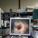 somtech Dr. Camscope (의료용 진단 카메라) 이미지
