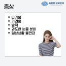 눈편한성모안과의원 네이버블로그