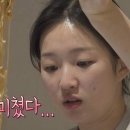김시현피부