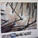 수지카클리닉센타 | 용인수지탈모 닥터모락에서 두피 관리 받고 느낀 후기