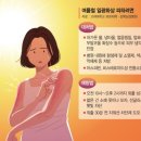 단백질·지방 함유한 우유, 땡볕에 달아오른 피부에 바르면 '명약' 이미지