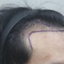 모나라피부과의원 이미지