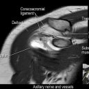 Shoulder internal rotation에서 통증이 있는 경우 살펴볼 부분들 이미지