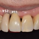 보일치과기공소 이미지