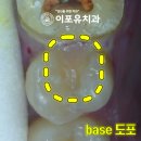 보강치과기공소 이미지