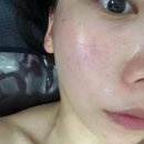 6505 | [퀸비] 대전 관저동 피부관리 예신관리 에너지테라피 후기
