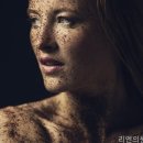리엔의원 네이버블로그