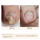 네일프리다 이미지