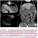 Gastric neoplasia로 진단된 13마리의 개에서 clinical, ultrasound, CT의 비교 이미지