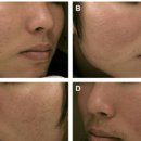 서울나온피부과의원 이미지