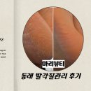 237플래닝 | 동래 패디플래닝 후기｜발각질 고민 해결한 마리뷰티 추천