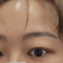 마스터메디 | 수지구청역 피부관리 용인 피부관리 레이저후관리 후기 마스터더뷰티