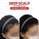 오직 스칼프 이미지