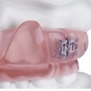 스타치과기공소 이미지