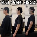 평택더리햅 | 평택 거북목 자세 교정이 될까요? (실제 레슨 전/후 후기)