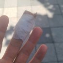 일신외과의원 | 전동 슬라이서에 손 베이고 네 바늘 꿰맸어요 ㅠㅠ 날붙이는 항상 조심!