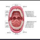 보험금의 지급사유[치아 관련 특별약관 1-1. 갱신형 치아보철치료비보장(임플란트 무제한) (영구치, 상해 및 질병) 특별약관] 이미지