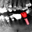 연세센트럴치과의원 이미지