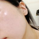 홀리에스테틱 - 고양시 일산서구 호수로 817 | 익산 모현동 소요 에스테틱 시그니처 관리 후기