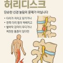 골반이 틀어지는 이유와 허리디스크의 관계 . 이미지