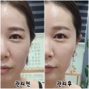 누누블리 | 민락동피부관리 가꾸는동안