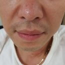 에이지에이 네이버블로그