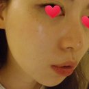 가림스킨케어 네이버블로그