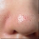 아쿠아빨래터 | 대구 남구 리안 스킨앤바디 얼굴윤곽관리 얼굴 작아진 리얼 후기