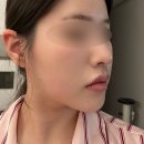 한승희뷰티 | [쎈언니 공구템] 가정용 인모드 기계 ’알록 찝프팅‘ 구매해보았어요. 내돈내산 사용후기