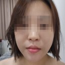 초지동시민시장주차장입구 | 안산 초지동피부관리 연뷰티앤바디 만족스러운 관리 후기