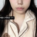 [분당 치과] 서울턱사랑니치과｜매복사랑니 발치 통증 및 비용 후기 당일 발치 치과 추천