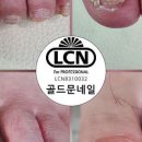 골드문네일 이미지