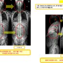 KPC 이미지