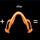 리온메디 이미지