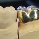 지안치과기공소 이미지