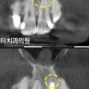 이승훈치과의원 네이버블로그