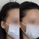 동원 | [천안두피 천안헤어라인 불당동원썸뷰티] 1:1 천안두피컨설팅 후기