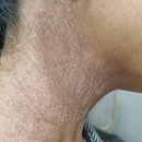 연세튼튼한의원 | 부산사직동피부과, 치료 목적인 곳은 물론 대학병원까지 가도 낫지 못한분께서 놓친 1가지