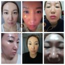 인셀덤 수원망포역점