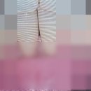 보타닉치과의원 | 앞니 레진 후기