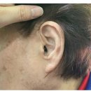 독일보청기 부천원미구청센터 이미지