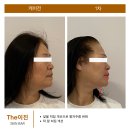 이진쵸이스 - 광진구 아차산로 401-14 | 이진쵸이스