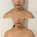 김포 에스테틱: 라파에스떼 :: JH윤곽술과 상체관리까지 한번에! 김포신부관리 웨딩케어 웨딩관리