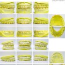 바른치과기공소 이미지