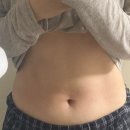 청산한의원 | 다이어트 나비약 대신 선택한 선택한 날씬한정 한 달 -4kg 후기 (비포애프터 有)